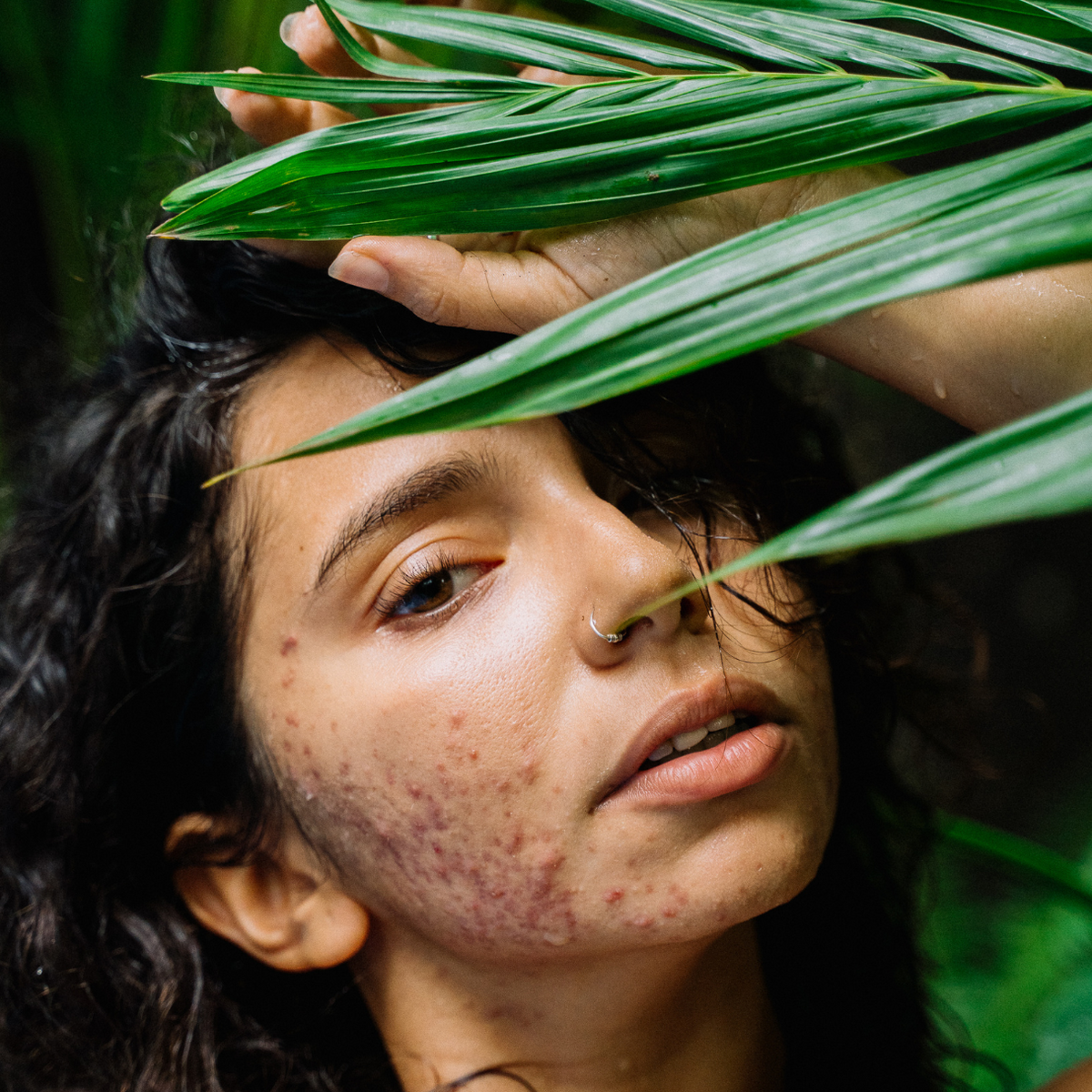 Portrait showing facial blemishes beside green leaves