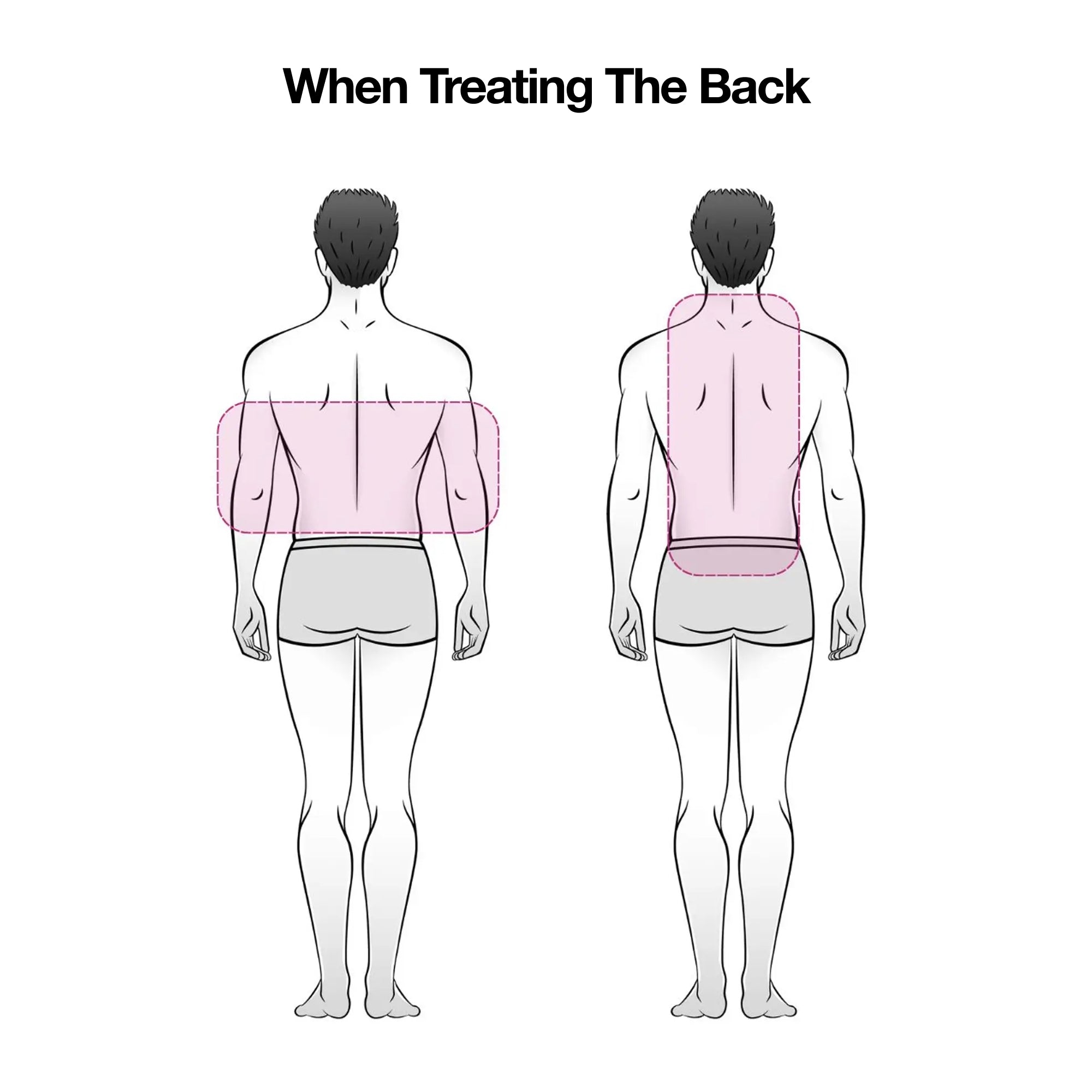 Celluma Treating back using celluma led light therapy, celluma red light therapy 最好的红光仪