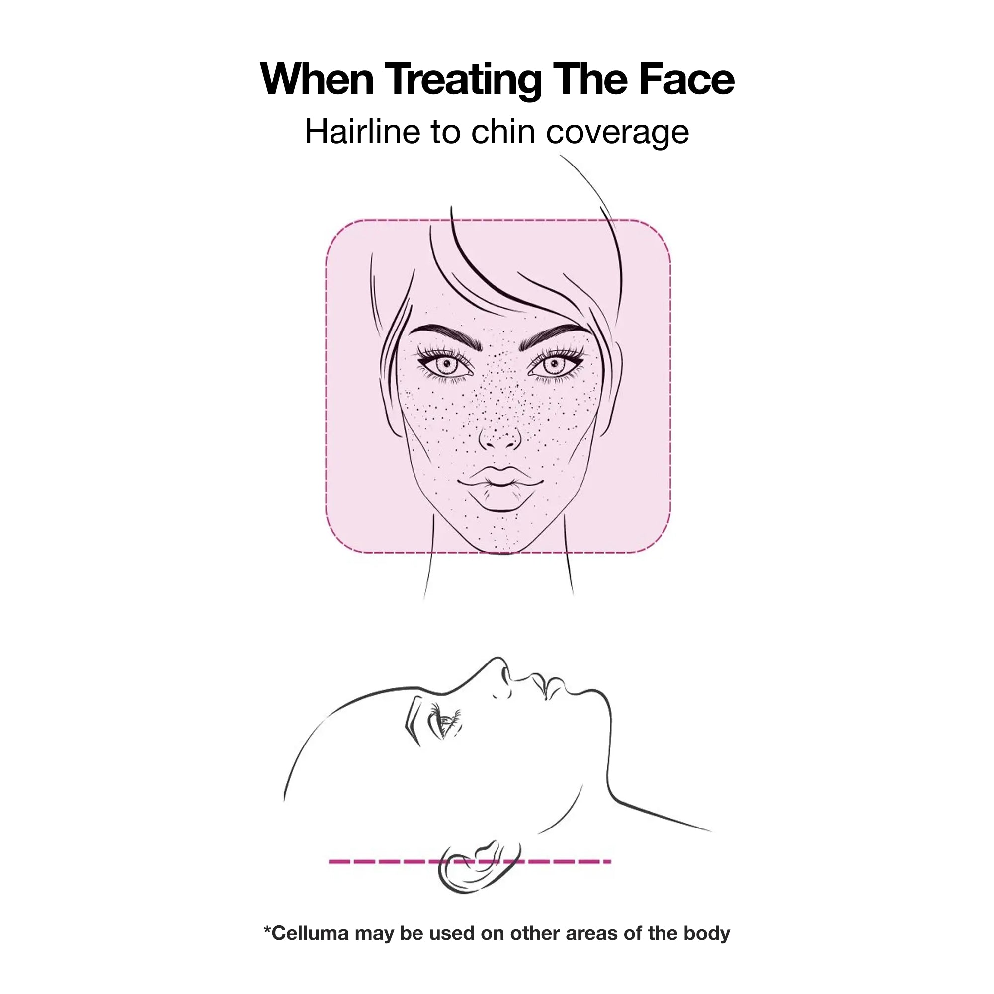 Celluma red light therapy, treats Wrinkles, collagen,Joint pain, Arthritis, Tendonitis, Hair loss, Androgenetic alopecia