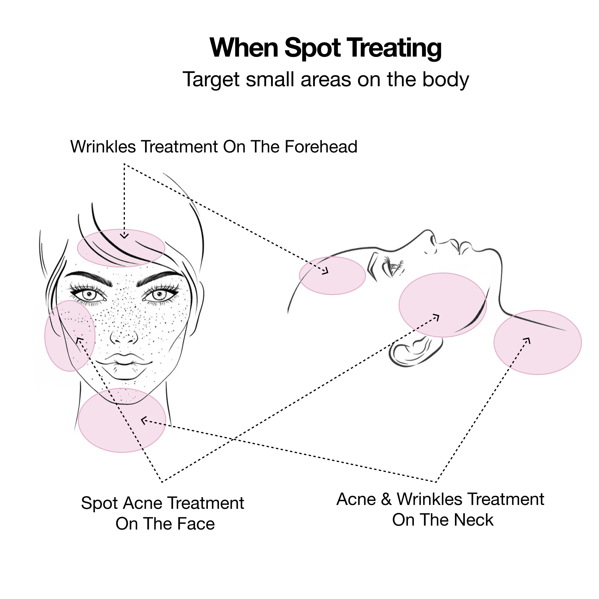 blue light, Red light, near-infrared light therapy Acne, Rosacea, Psoriasis, Eczema, Dermatitis, scars, hyperpigmentation, Wrinkles, collagen, crow’s feet, aging, Hair loss, Androgenetic alopecia,  Joint pain, Arthritis, Tendonitis, Backache, frozen shoulder, Sciatica, nerve pain, chronic pain