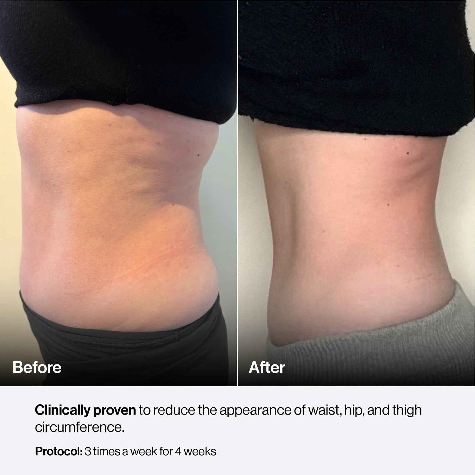 Woman using Celluma Nova LED red light Therapy for Body Contouring with good results.  